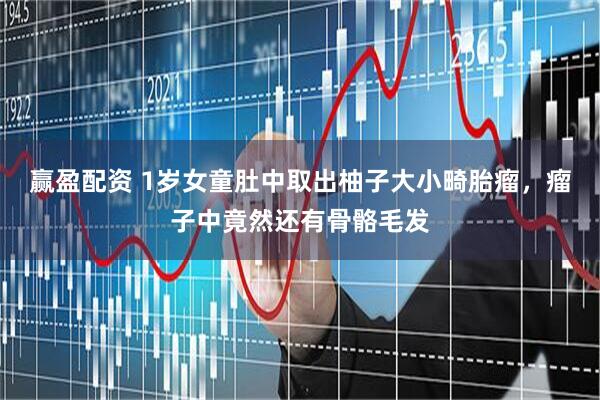 赢盈配资 1岁女童肚中取出柚子大小畸胎瘤，瘤子中竟然还有骨骼毛发